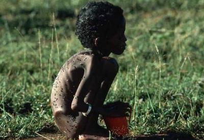 1 milyarı bulan açlığın sebebi ne?