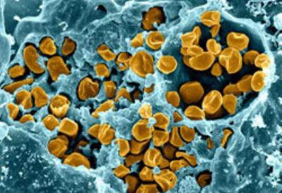 ABD'yi korkutan ölümcül hastalık