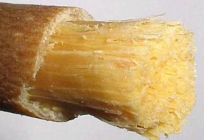 Sağlıklı diş için ne yapmalı ne yapmamalı