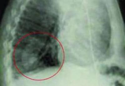 Müsadenizle sizin akciğere bezelye eksek...