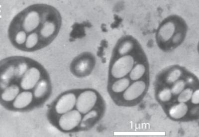 Zehir yiyip ölmeyen bakteriler bulundu