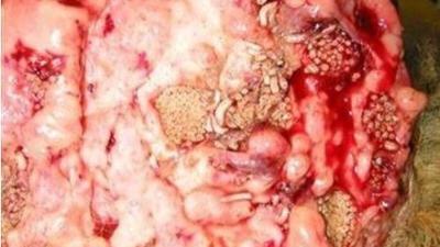 Domuz eti yemekten beyni kurtlandı