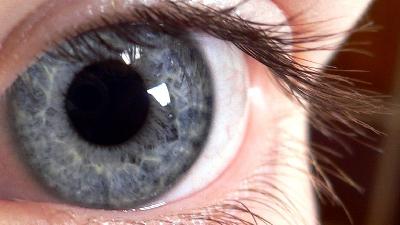 Kornea nakli ile ilgili bilinmeyenler!