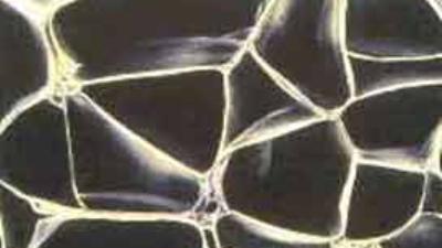 Meme kanserine yol açan gen bulundu!