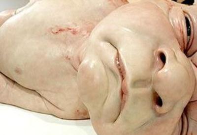 Bu çocuklar neden insana benzemiyor, neden böyle doğdular?