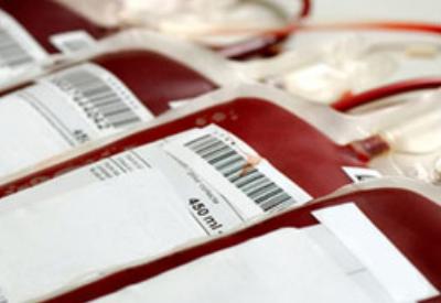 AIDS'li kana 787 bin TL tazminat