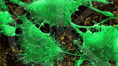 Kanseri önlemenin basit yolları