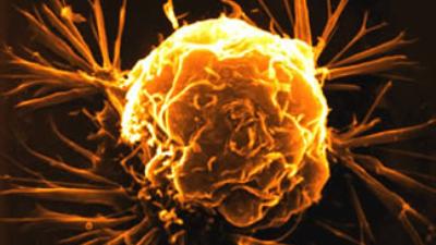 Satılan hastalıklar...