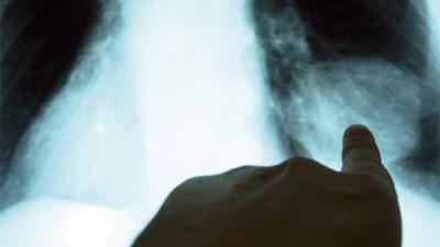 Kot taşlama yasaklandı