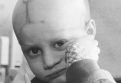 Kanser 30 yaşın altında hızla artıyor! Neden acaba?