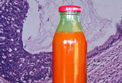 Gıdaların içinden çıkanlar iki grup haricinde herkesi iğrendirdi