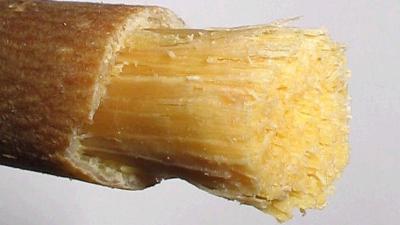 Ağız ve beden sağlığınız için diş fırcanızı atın