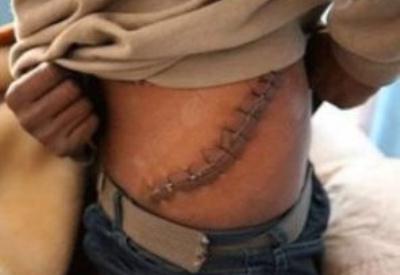 Dünya organ mafyası vampirleri konuşuyor