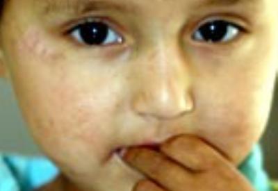 Çocukların erken ergenliğinden kim ne rant sağlıyor