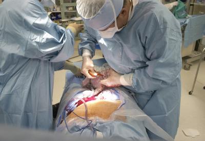 Sezeryan fıtrata müdahale